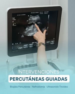 Lee más sobre el artículo Intervenciones Percutáneas Guiadas